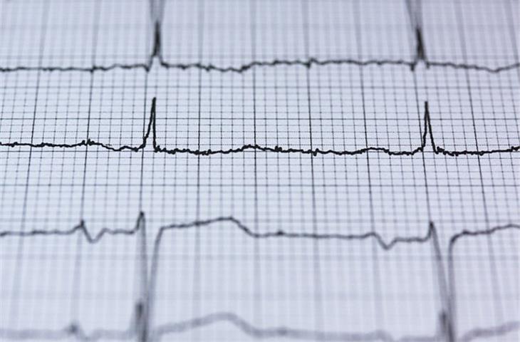 skx 2000 ecg simulator