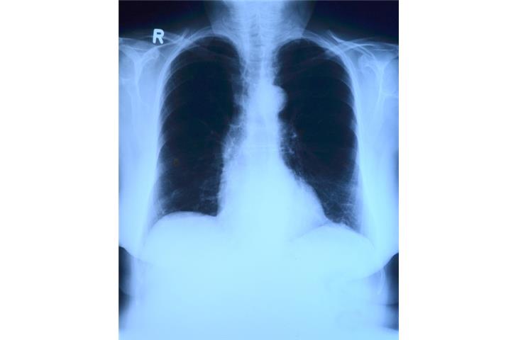 Dental X-ray imaging performance testing equipment